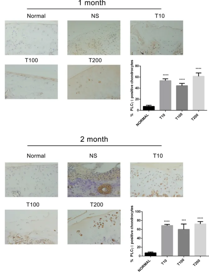 Figure 5: Effect of Akt inhibitor on PLCγ1 expression in a rat OA model.  Specimens were longitudinally cut into 3 μm  sections and the levels of Aggrecan expression level were detected by immunohistochemisty technique (original magnification ×200)