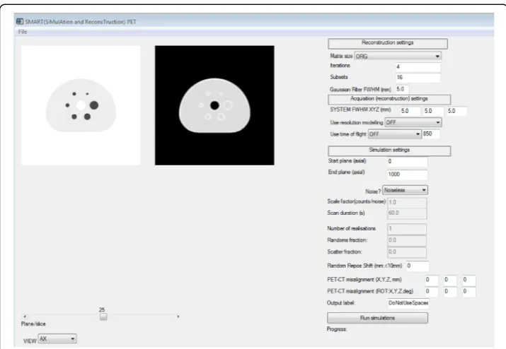 Fig. 1 The SMART-PET GUI. On the upper left, the parameters of the reconstruction can be set, like matrixsize, number iterations/subsets, resolution modelling ON/OFF and TOF ON/OFF
