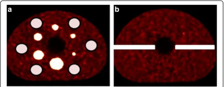Fig. 2 The regions of interest used to a calculate the COV in the phantom background at slice 38 andb the intensity distributions of the standard deviation image at slices 53–57 (right)