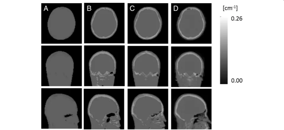 Figure 2 shows axial slices of the last PET frame (65–70 min) at the height of the striatum, occipital pole, andcerebellar cortex of an exemplar subject, reconstructedusing μ-mapDXN, μ-mapdUTE, μ-mapdUTE−R2, and pCT,together with the En obtained in each ca