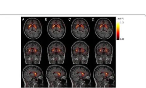 Fig. 4 Axial (left), coronal (middle), and sagittal (right) views of the normalised voxel-wise En maps obtained with the μ-mapDXN (a), μ-mapdUTE(b), and μ-mapdUTE−R2 (c), overlaid on the MRI template