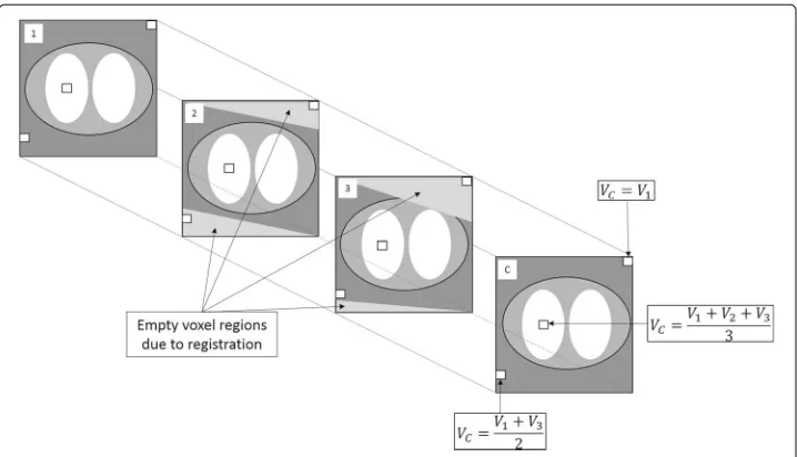 Fig. 1 Schematic of the method to combine the CT data. 1, 2 and 3 represent the CT images from the early,mid and late study sections; C is the resulting combined-CT image; and V is the concentration in the voxel ofinterest