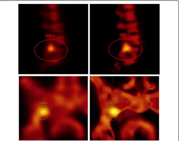 Fig. 2 Examples of VOI placed on bone for F3D (left) and xB (right)