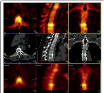 Fig. 5 Reduction of false positive findings with xB. Despite some suboptimal xB images, five of nine F3Dreads were deemed malignant and thus as false positive relative to the surrogate ground truth