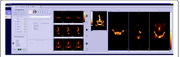 Fig. 1 The user interface of clinical evaluation software