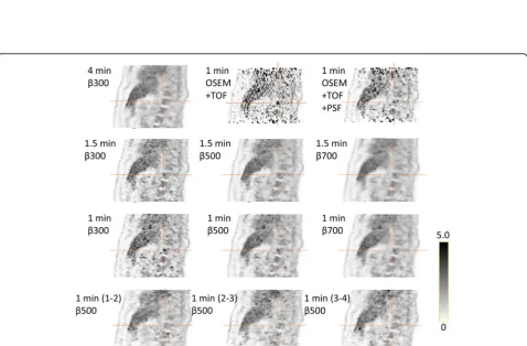 Fig. 4 Example of a lesion (right adrenal gland, indicated by the arrow) and how it appears in the reference with an AT of 16 (4 MBq/kg and 4min/bed position with a β of 300) and the combinations of time/bed position and β values evaluated