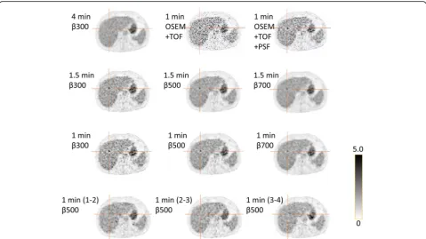 Fig. 6 Example of a lesion in the liver not visible in the 4-min reference (upper left corner), to different degrees, visible in the other combinationsof time/bed position and β values evaluated
