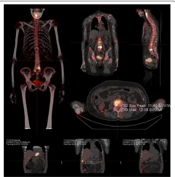Fig. 7 Absolute quantification is possible with Hybrid Recon™ (Hermes Medical Solutions)