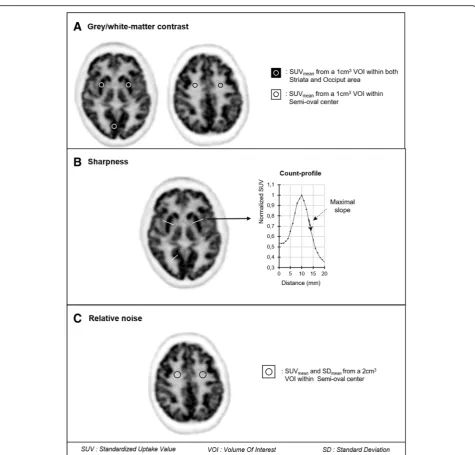 Fig. 2 Schematic representations of methods used on axialperipheral (occiput) gray-matter structures and a white matter structure (semi-oval center), 18F-FDG brain PET images to a quantify the contrast between central (striata) or b determine the sharpness index through the maximalslope of count profiles obtained perpendicularly to the gray/white-matter interfaces of striata and occiput and further normalized to the maximalcurve value, and c quantify the noise level within the semi-oval area