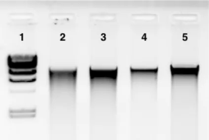 Figure 1: Total DNA purified from wheat field soil with four different lysis buffer  combinations