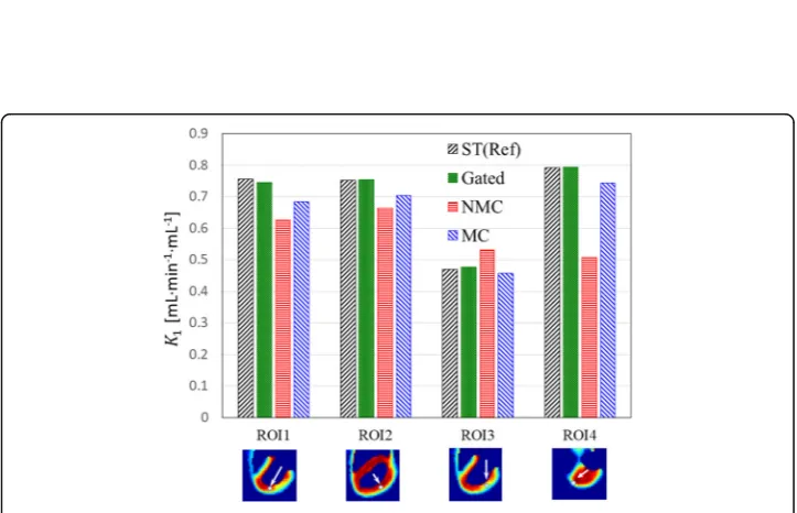 Fig. 6 Estimated K1 maps and line profiles. a GA, NMC, and MC K1 maps for CM and CRM as well as ST K1map