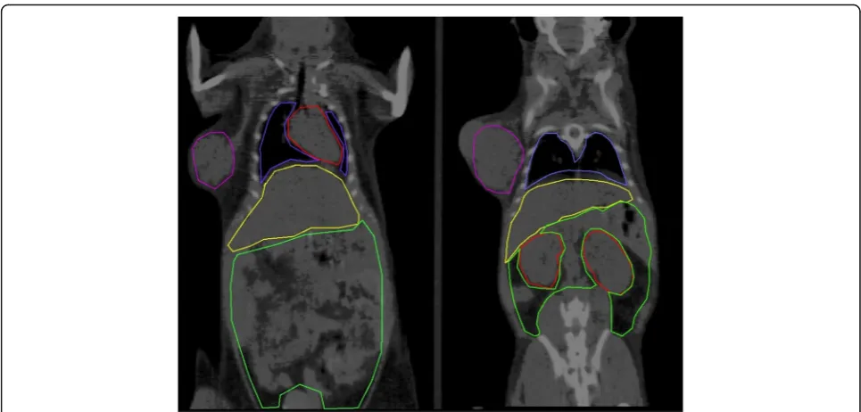 Fig. 2 Example of manual CT-based segmentation of most relevant thoracic (heart, lungs) and abdominal organs (liver, kidneys, and intestines),along with a subcutaneous tumor on the right flank