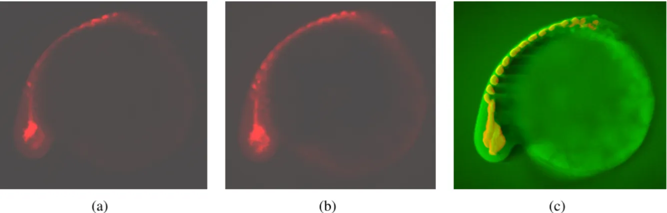 Figure 1: The zebrafish gene expression pattern of the MyoD gene at 24 hours post fertilization (hfp)