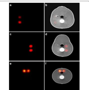 Fig. 6 SPECT and SPECT-CT images in the transverse plane representing the anatomical structure of thehead and neck phantom; images a and b show two superficially low activity uptake simulated SLNs ingamma and hybrid modes (0.1 and 0.2 MBq, respectively)