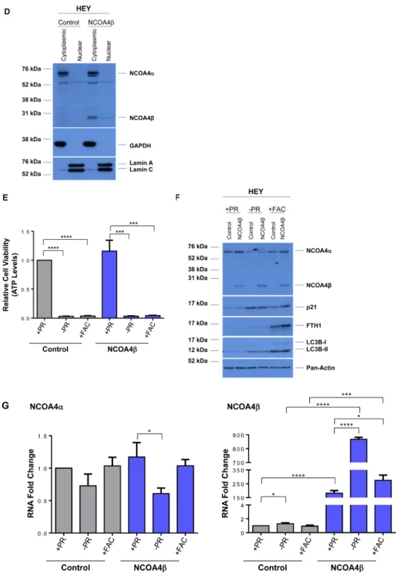 Figure  5:  NCOA4β  overexpression  in T80,  HEY,  and  PE-A-OCV  cells  reduces  colony  forming  ability