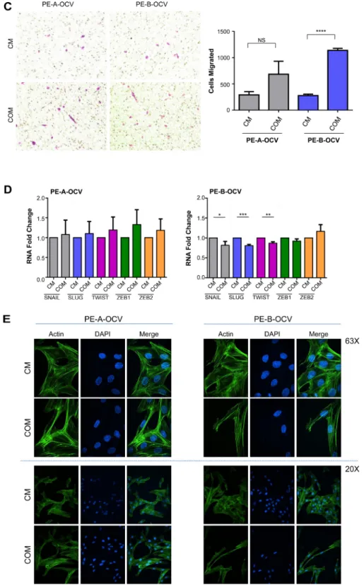 Figure 2: Conditioned media from senescent primary endometriotic cells promotes migration of transformed  endometriotic cells