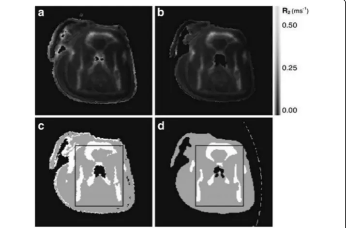 Fig. 8 Transverse slices of uncorrected (a) and corrected (b) R2 maps and segmented MR (c) and CT (d)images of phantom (This research was originally published inV