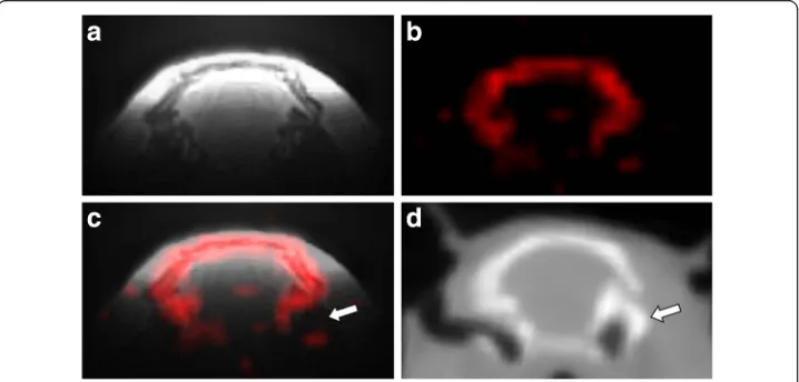 Fig. 3 MRI and CT images acquired on the rat head in vivo. 1H anatomical MRI (a), 31P-ZTE MRI (b), fusion(c), and low resolution CT (d)