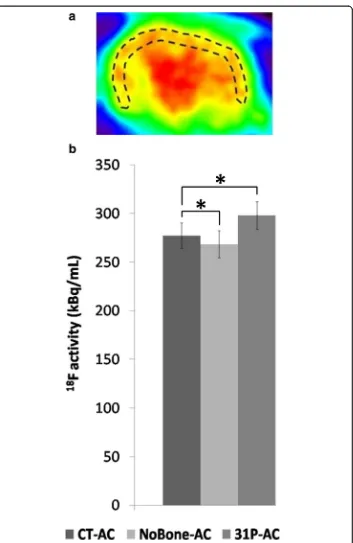 Fig. 5 Peripheral brain ROI (a) in which 18F activity was measured for the three different attenuationcorrections (b)