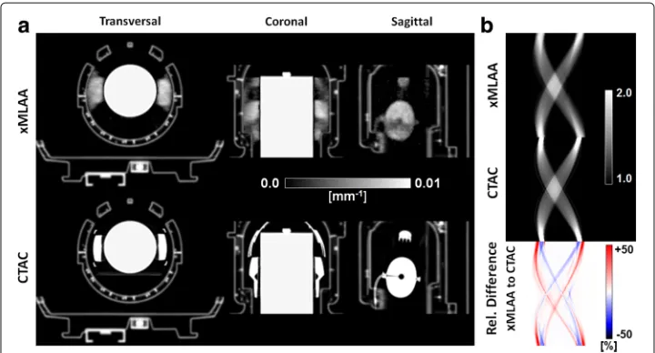 Fig. 6 Results for the HP experiment: attenuation.and CT-based attenuation maps.sinograms correspond to the same transversal plane as shown in ( a Transversal, coronal, and sagittal views of the xMLAA- b Attenuation correction factors (ACFs) of the headpho