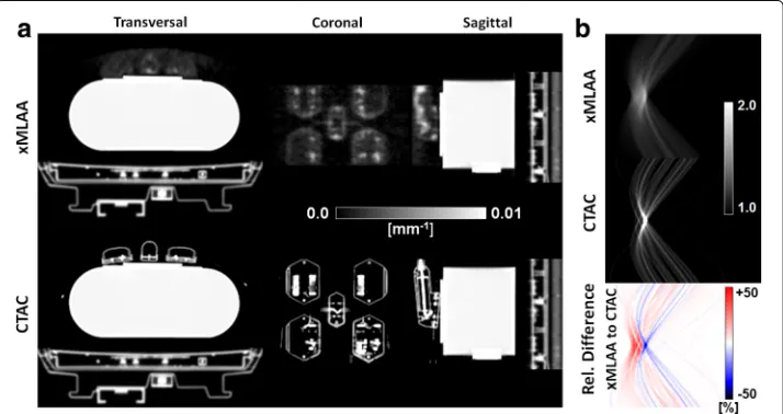 Fig. 8. The different structures of the RF coil visible in the CT-based attenuation mapcan also be identified when using xMLAA