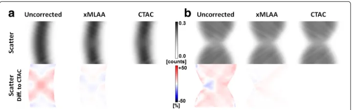Fig. 11 Effects of inaccurate scatter. a Sinograms showing the scatter estimates obtained with the SSSalgorithm and corresponding to the uncorrected, xMLAA-based, and CTAC-based attenuation maps in caseof the HP experiment