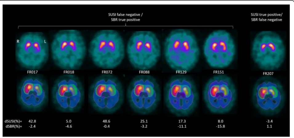 Fig. 2 ROC curves for identification of neurodegenerative etiology of parkinsonism (mono-site/mono-camera setting, a) or PD (multi-site/multi-camera setting, b)