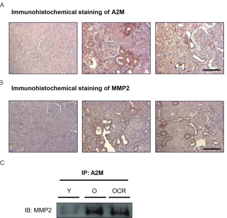 Figure 3: Effects of aging and CR on A2M-MMP2 interaction.  (A) The expression of A2M is visualized by immunohistochemical  methods