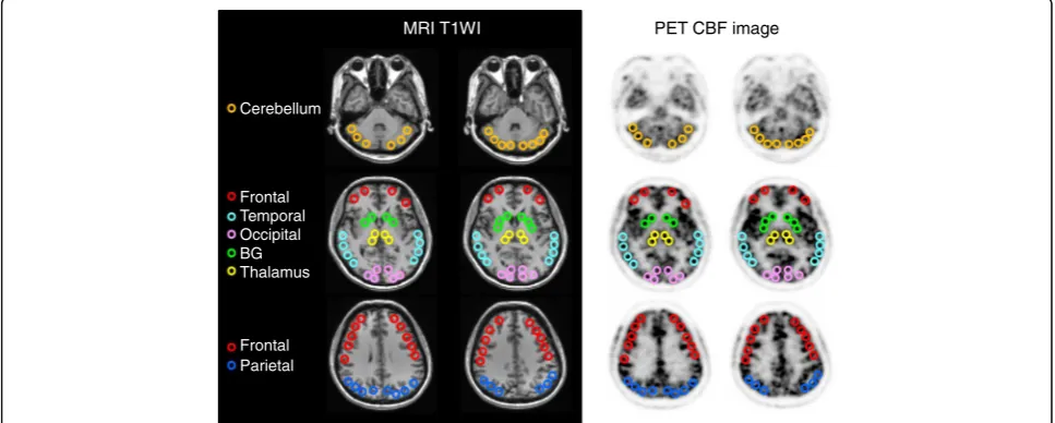 Fig. 1 ROIs on several representative slices of MRI (left two columns) and PET (right two columns)