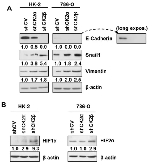 Figure 4: Expression of EMT markers and HIFα in HK-2 and 786-O cells silenced for CK2 subunits