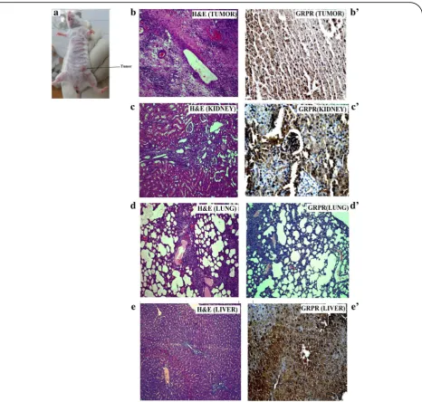 Fig. 7 Histological and immunohistochemical micrographs of MDA-MB-231 cells induced mice tumor