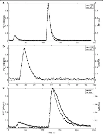 Fig. 5 Comparison of normalized (respective maximum signal intensity) AIFs derived from both PET and MRsignal traces at a myocardial perfusion rate of 4 ml/g/min and cardiac output of 3 l/min