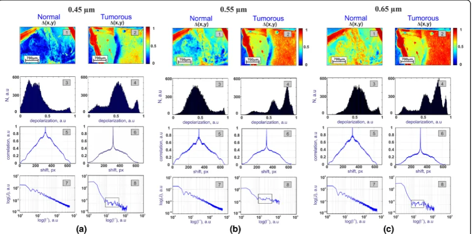Fig. 2 Examples of depolarization distribution Δ - (1, 2), N (Δ) histograms – (3, 4), autocorrelation functions KΔ(Δx) – (5, 6) and powerspectra (log J(Δ) - log l− 1) – (7, 8) obtained for normal and cancerous paraffin-embedded tissue blocks, measured in t