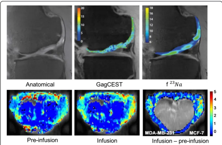 Fig. 6 (top) Gag-CEST showed a high correlation with the Gag distribution map obtained using 23Na MRimages in joint cartilage (reproduced from [64] with permission); (bottom) D-glucose is infused in miceinoculated with breast tumors, and the difference between Gluco-CEST pre- and post-infusion imagesshows increased glucose levels in the tumors (reproduced from [67] with permission)
