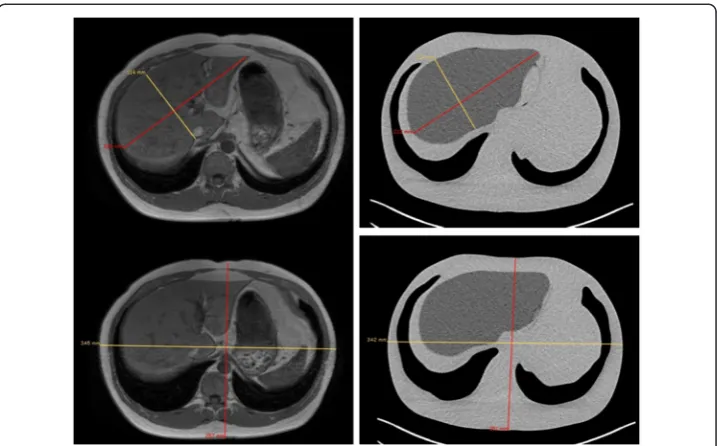 Table 5 Phantom dimension measurements compared to the original MRI dimensions