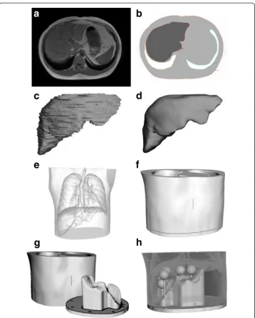Fig. 1 Transaxial slice of the MR scan (lesion inserts (design assembled (a) and segmented organs (b)