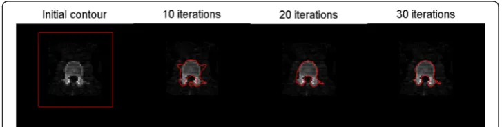 Fig. 2 Example of the active contour evolution process from initial to final contour, depicting the detectionof the outer bone contour of lumbar vertebrae in a single CT slice