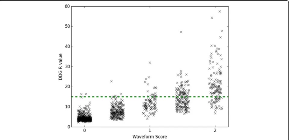 Fig. 3 Example waveforms showing the first 120 s (out of 240 s) of data for five different bed positions