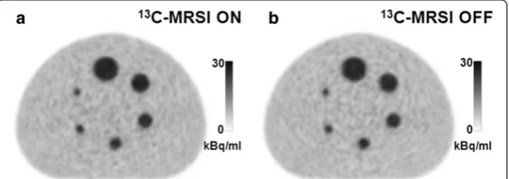 Fig. 3 Examples of PET during 13C-MRSI ON and OFF. PET with a simultaneous 13C-MRSI (scan number 1)and b without any MRI performed (scan number 2)