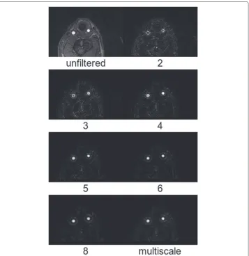 Fig. 6 Transverse cross-sections of the vessel-filtered TOF-MRA data as a function of sphere radius in mm.The original unfiltered TOF-MRA data and the result from the multiscale combination (Eq