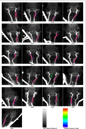 Fig. 5 Arterial segmentations from MR angiography overlaid onto coronal maximum-intensity projections ofthe PET data