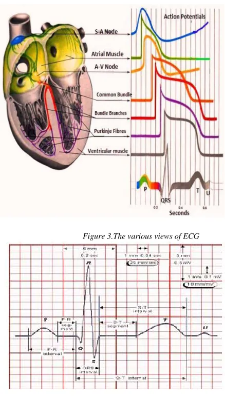 Figure 3.The various views of ECG 