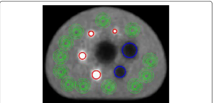 Fig. 3 Position of the regions of interest (ROIs) placed over the active spheres ((red), nonradioactive spheresblue) and the phantom background (green) of the reconstructed PET images, which are used for analysis