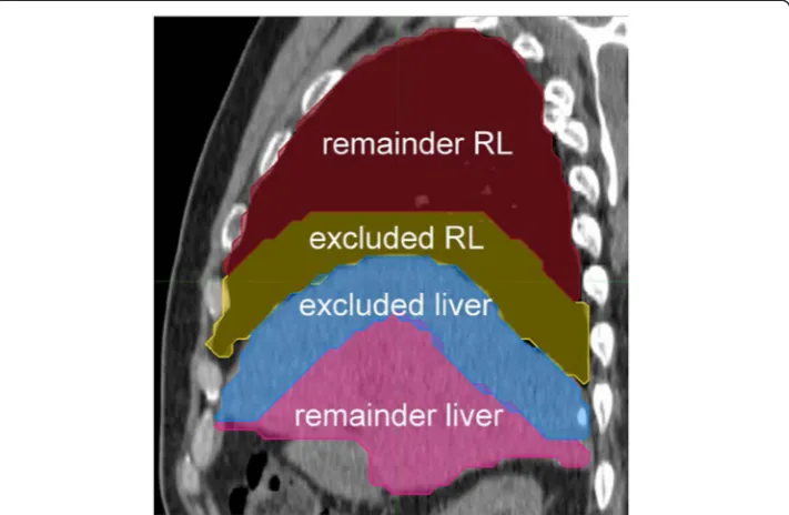 Fig. 2 Schematic geometry of the simulations for the liver-lung interface with uniform activity in the slabrepresenting either the liver (a) or lung (b)