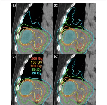 Fig. 4 The correlation of patient absorbed doses from MC with those from LD (green triangles), SK (redsquares), and SKD (blue diamonds) for tumor AD�� (N = 31) (a), NL AD�� (N = 17) (b), and RL AD�� (N = 17) (c) showntogether with their linear fits