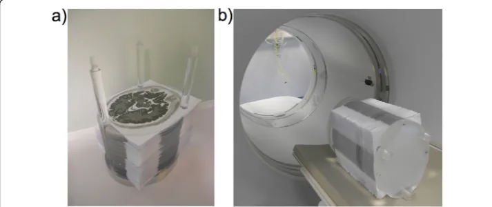Fig. 1 a Partially assembled printed SS phantom and b assembled phantom positioned on the scanner bed