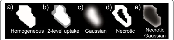 Fig. 2 Modelled tumour patterns shown in a transverse slice of the irregular lesion. a Homogeneous