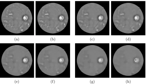 Fig. 2: Illustration of Morphological Processing stage. (a, b) First, (c, d), second, (e, f) third, and (g, h) fourth morphological opening and closing iteration