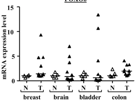 Figure 1: FOXO6 mRNA expressions in various cancers and normal tissues.  Scatter dot plot with median of qRT-PCR data for 