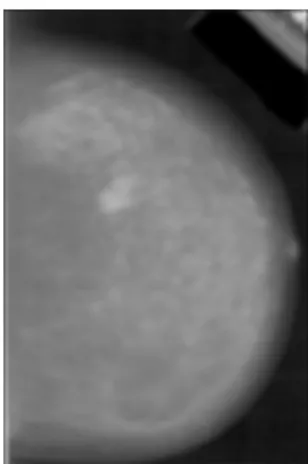 Figure 2 Image from Figure 3.9 after 20x20 average filter 